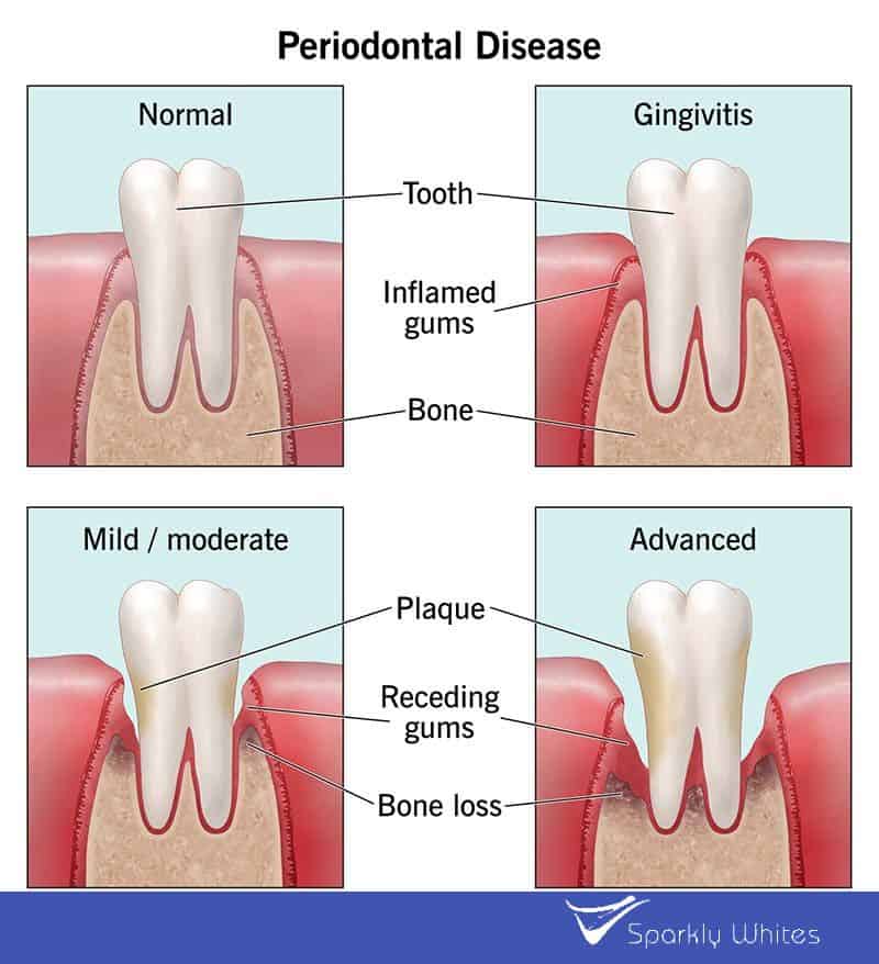 If Your Gums Could Talk, What Would They Say About Your Health Barnsley?