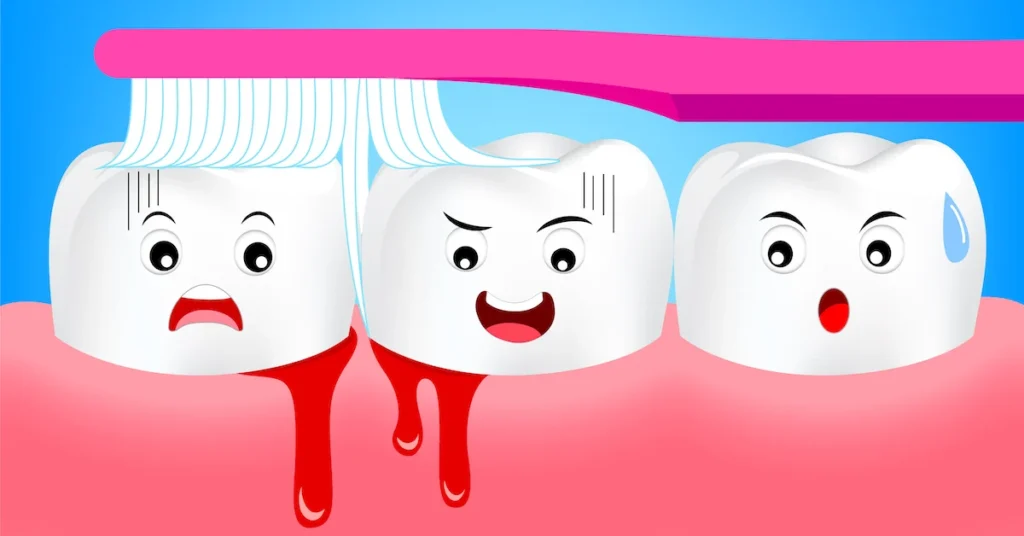 Is Bleeding Gums an Early Sign of Gum Disease Barnsley?
