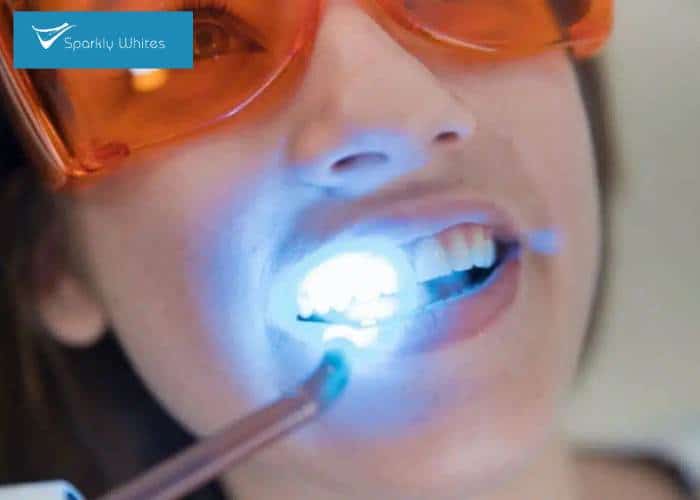 Is One Whitening Method Safer for Crowns, Fillings, or Dental Work Barnsley?