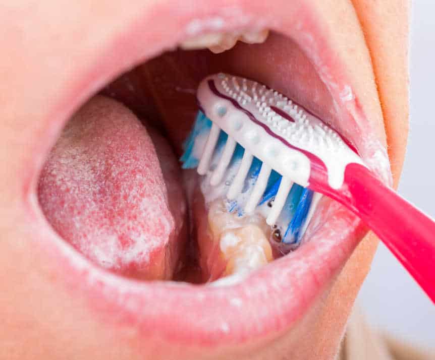 Proper oral hygiene tools, including toothbrush, floss, and mouthwash, essential for maintaining white teeth Barnsley